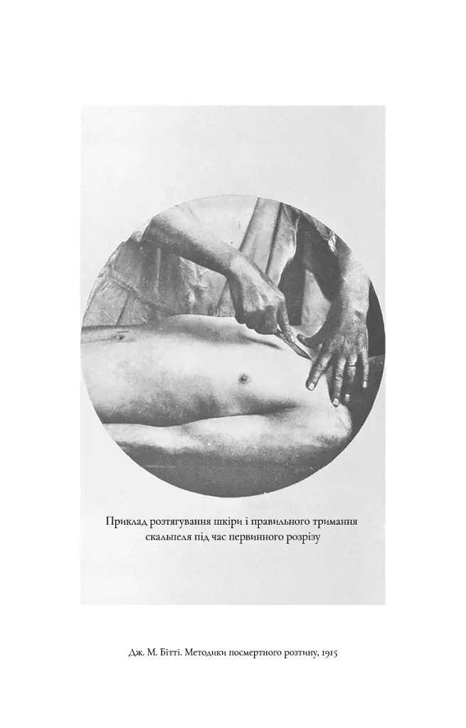 По сліду Джека-Різника. Книга 1: По сліду Джека-Різника - фото 8