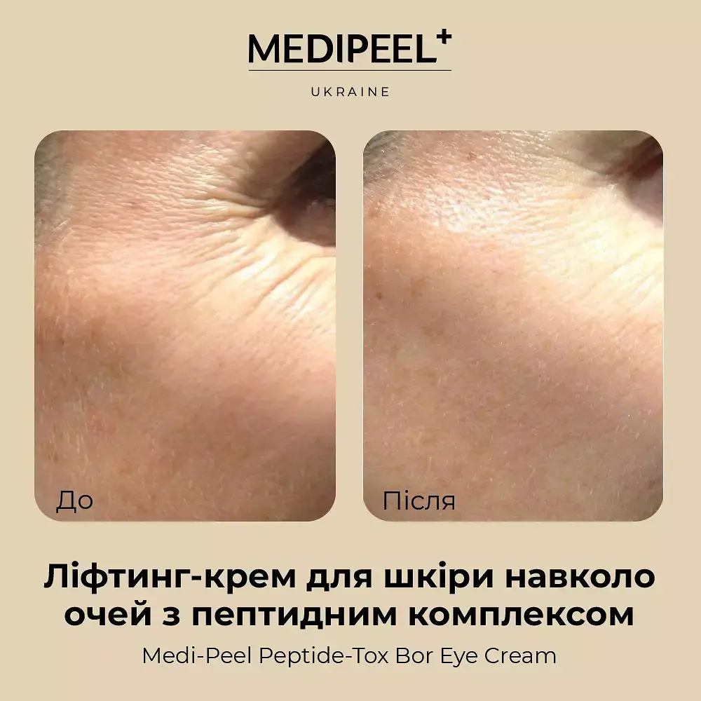 Ліфтинг-крем для шкіри навколо очей Medi-Peel Peptide-Tox Bor Eye Cream з пептидним комплексом 40 мл - фото 5