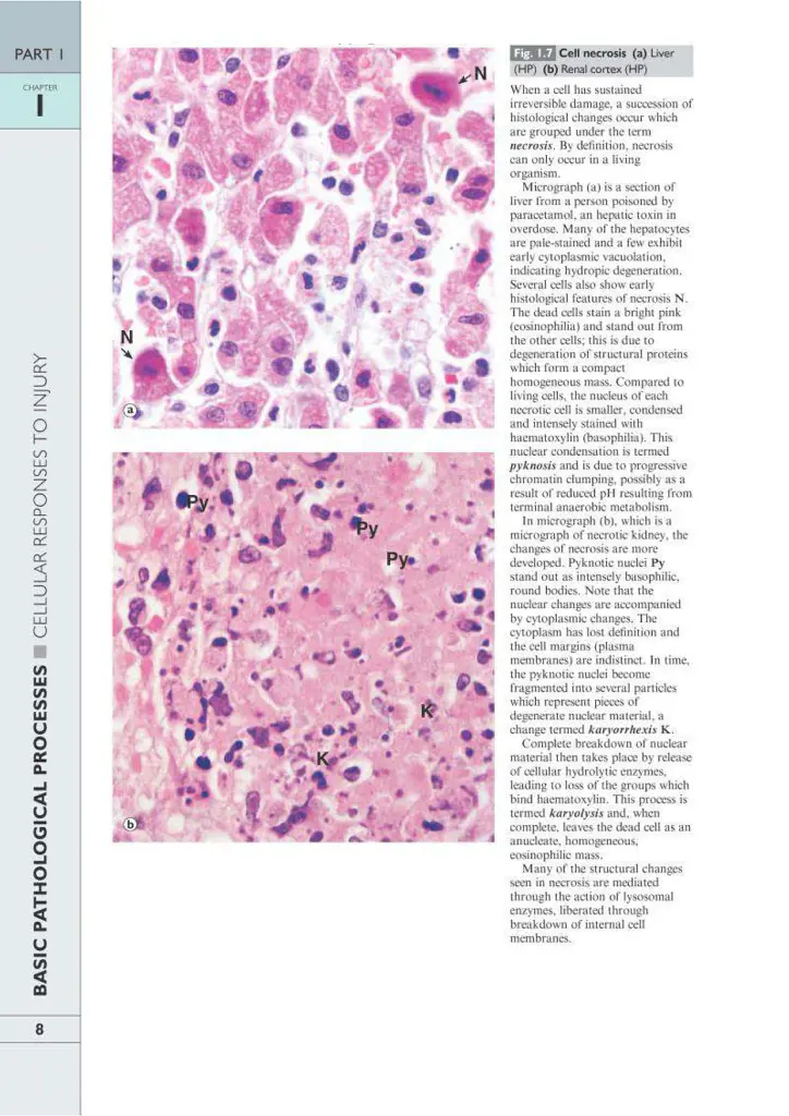 Wheater's Basic Pathology: A Text, Atlas, and Review of Histopathology. International Edition, 5th Edition - Вільям Стюарт - фото 11