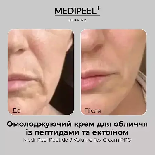 Омолаживающий крем для лица с пептидами и эктоином Medi-Peel Peptide 9 Volume Tox Pro Cream - фото 2