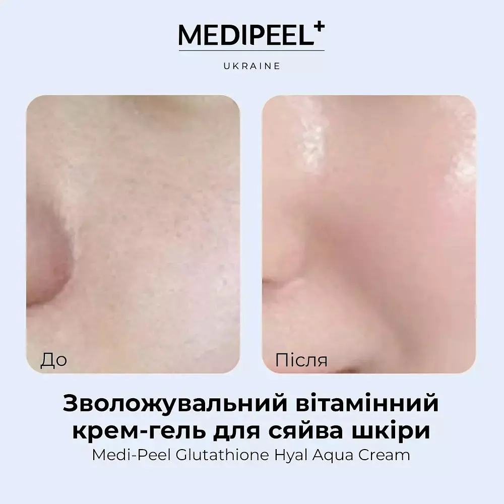 Крем-гель для обличчя Medi-Peel Glutathione Hyal Aqua Cream зволожувальний вітамінний 50 мл - фото 5
