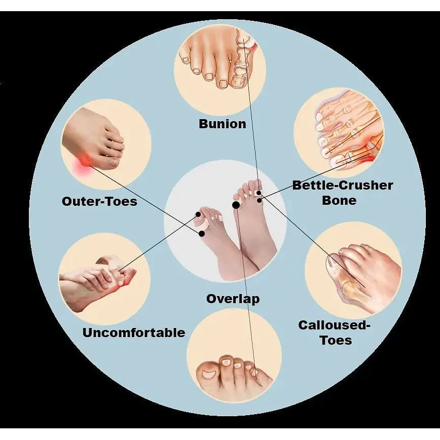 Коректор розділювач для пальців ніг силіконовий дорослий 2 шт. White (16379) - фото 4