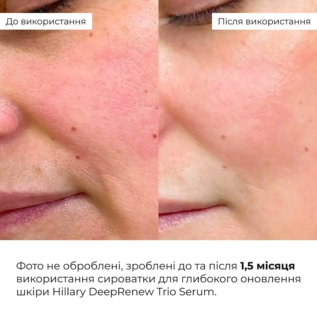 Сироватка для глибокого оновлення шкіри Deep Renew Trio Serum Hillary 30 мл - фото 5