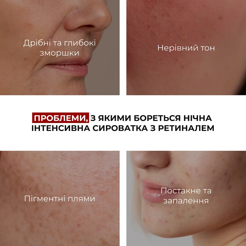 Нічна інтенсивна сироватка з ретиналем Night Intense Retinal Serum Hillary 30 мл - фото 6