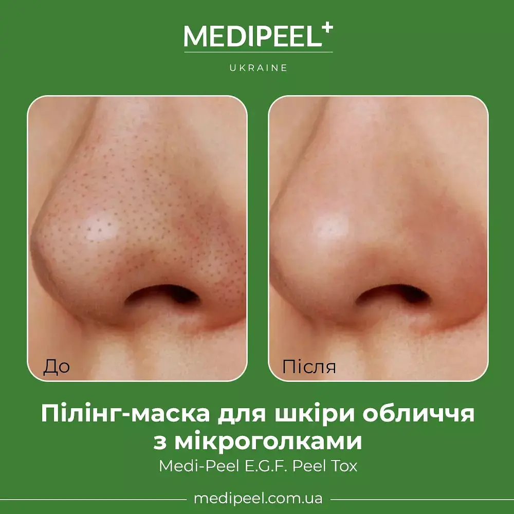 Пілінг-маска для шкіри обличчя  Medi-Peel E.G.F. Peel Tox з мікроголками 70 г - фото 2