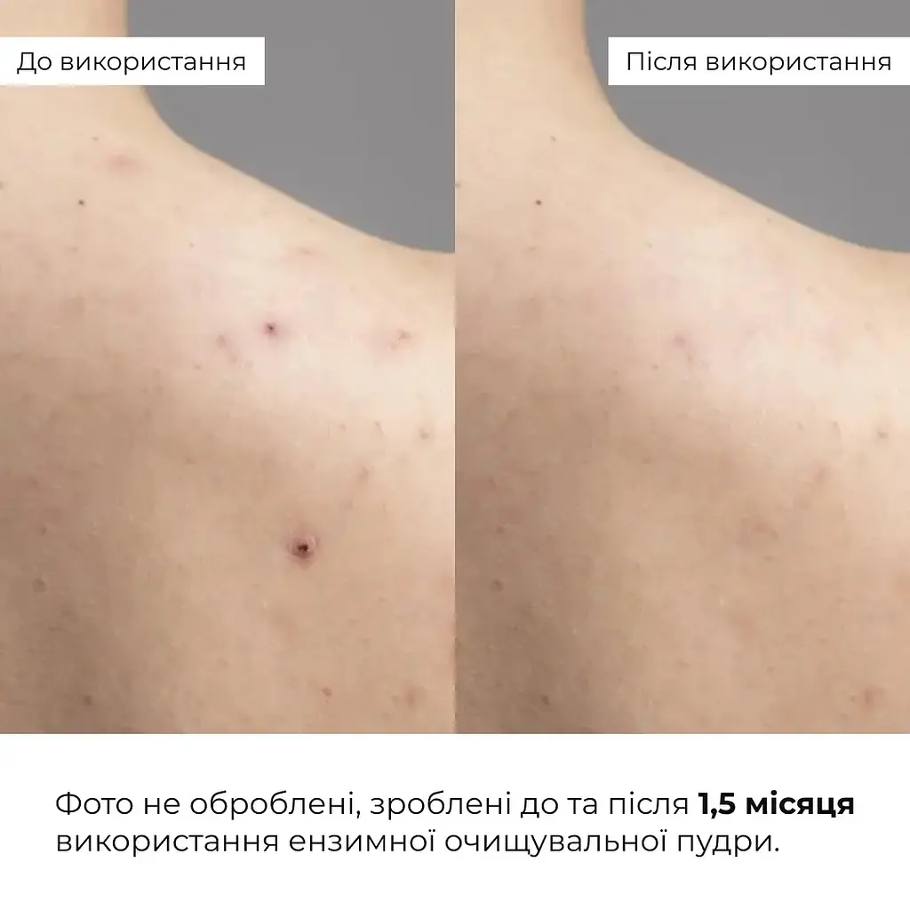 Ензимна очищувальна пудра Hillary Enzyme Probio Cleanser Powder для нормальної сухої та чутливої шкіри 40 г - фото 10