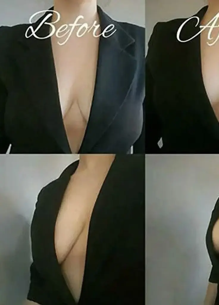 Бюстгальтер-ліпучка для підняття грудей Finetoo Чорний L/XL - фото 3