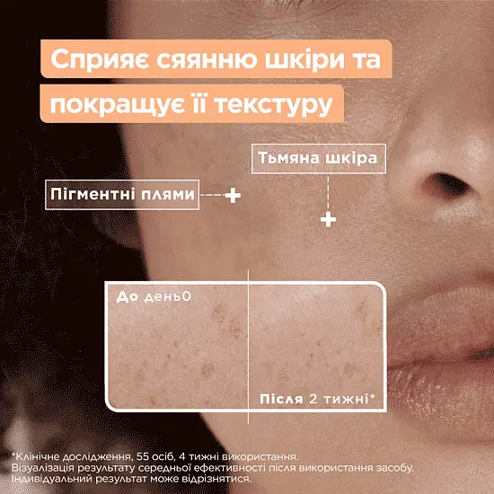 Сироватка Mixa для сяяння тьмяної чутливої шкіри обличчя 30 мл - фото 3