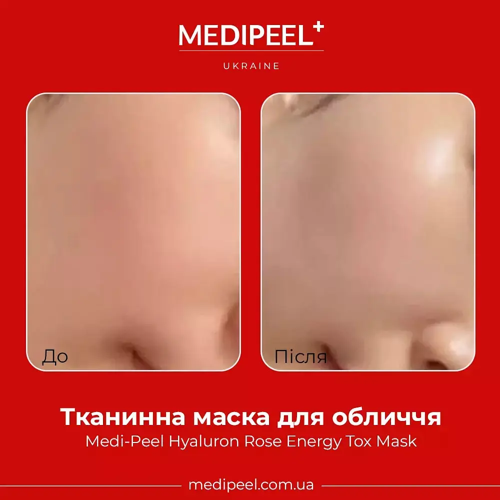 Тканевая маска для лица Medi-Peel Hyaluron Rose Energy Tox Mask 30 мл - фото 2