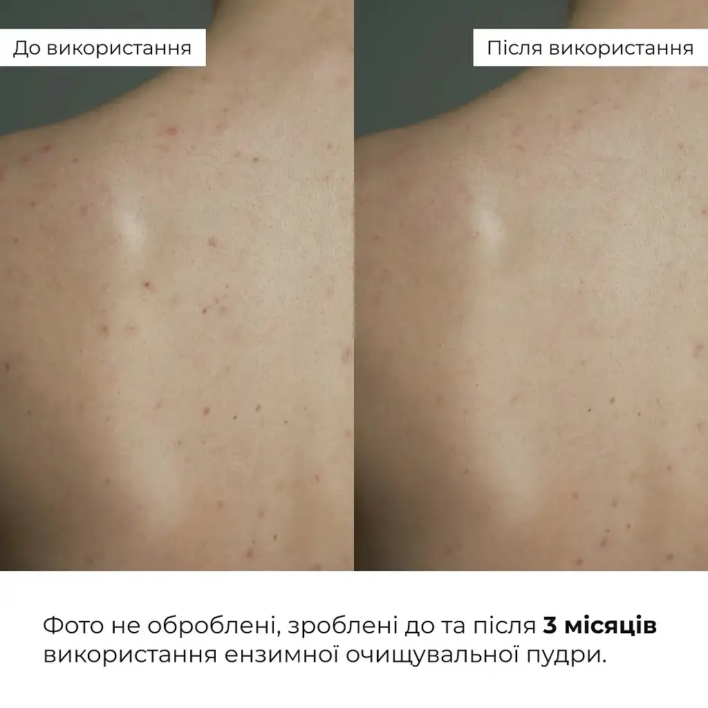Энзимная очищающая пудра Hillary Enzyme Balance Cleanser Powder для жирной и комбинированной кожи 40 г - фото 10
