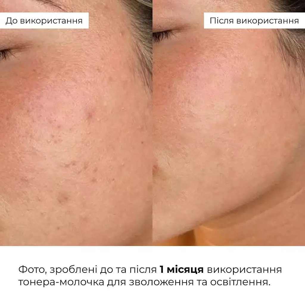 Тонер-молочко для увлажнения и осветления кожи Milky Glow Toner Hillary 100 мл - фото 7