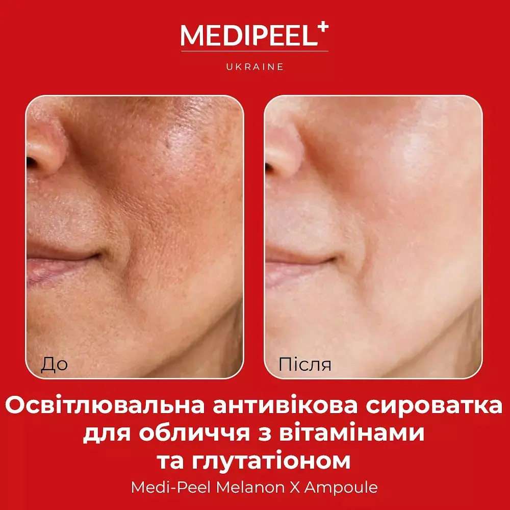 Сироватка для обличчя Medi-Peel Melanon X Ampoule  з вітамінами та глутатіоном освітлювальна 50 мл - фото 4