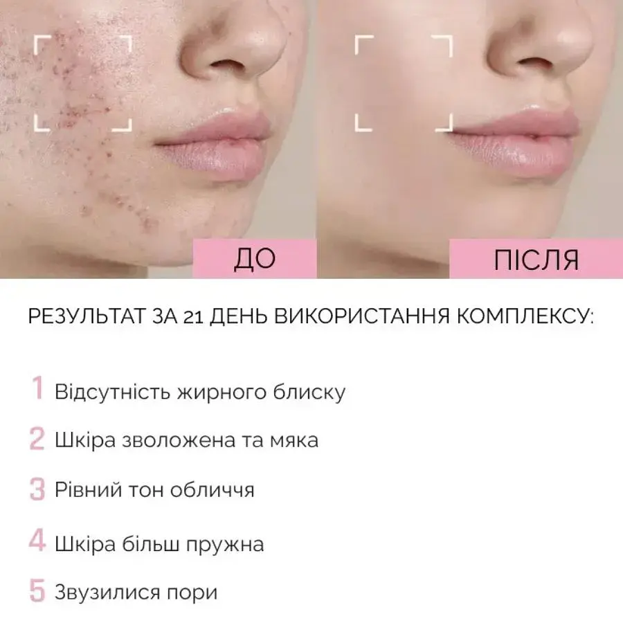 Відновлююча сироватка для обличчя з ніацинамідом та гіалуроновою кислотою Reclaire cosmetics 30 мл - фото 4