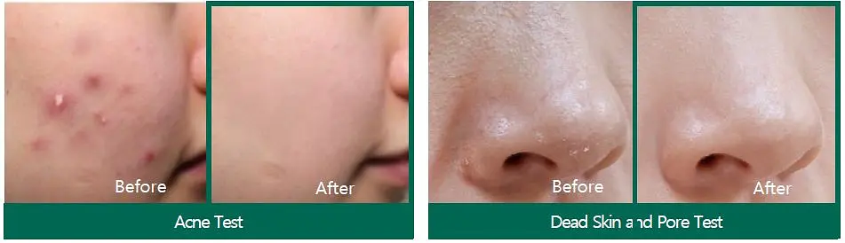 Крем для обличчя Some By Mi AHA-BHA-PHA 30 Days Miracle Cream відновлювальний з комплексом кислот 60 мл - фото 3