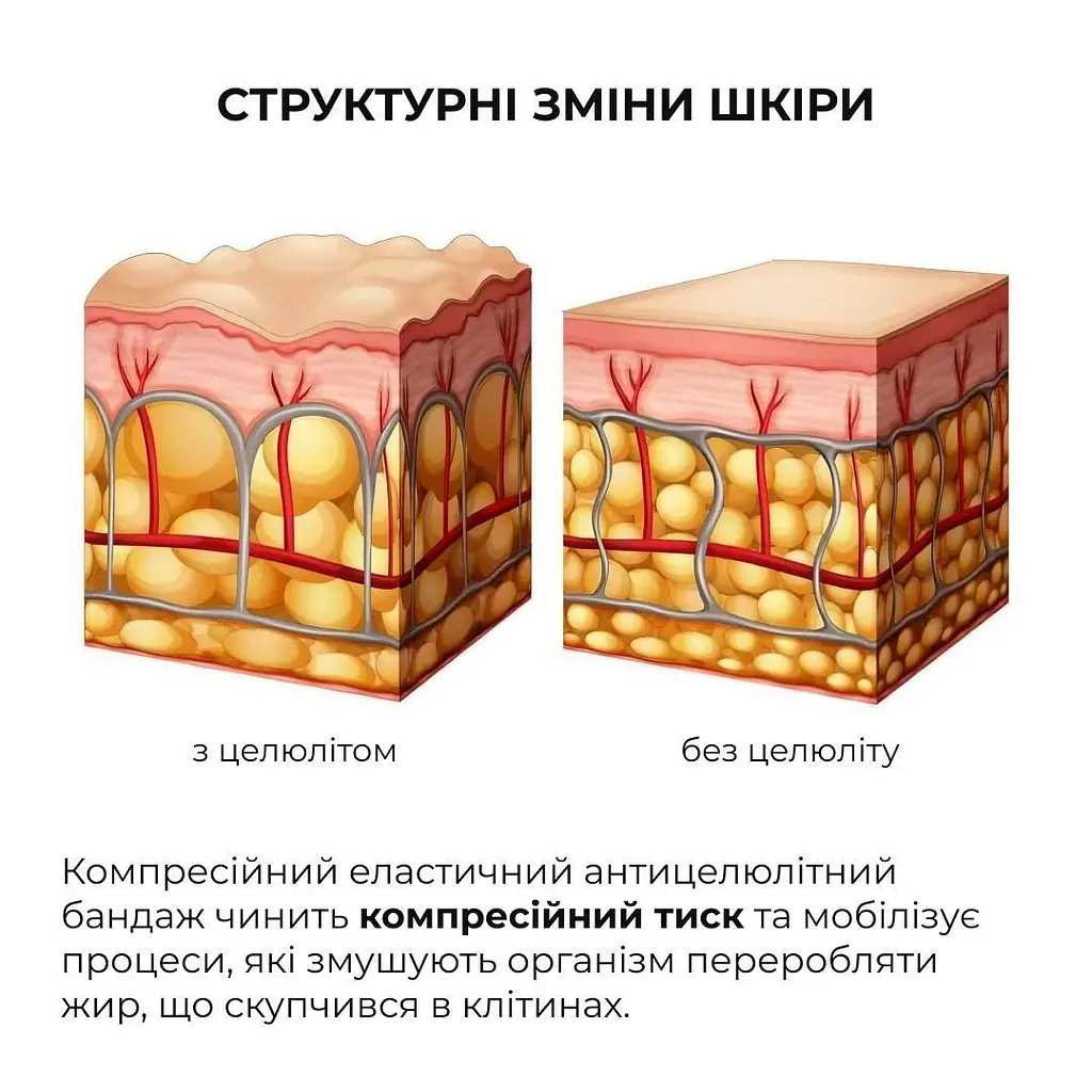Уцінка. Набір антицелюлітних розігрівальних обгортань Hillary Heating Anti-Cellulite Wrap Set  - фото 3