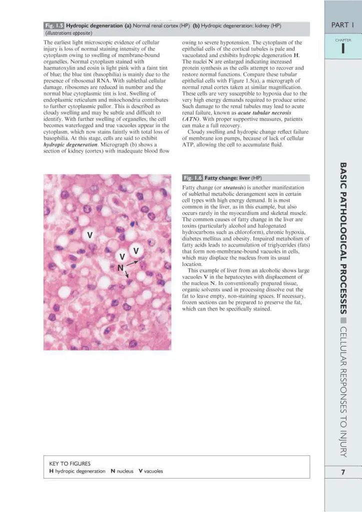 Wheater's Basic Pathology: A Text, Atlas, and Review of Histopathology. International Edition, 5th Edition - Вільям Стюарт - фото 10