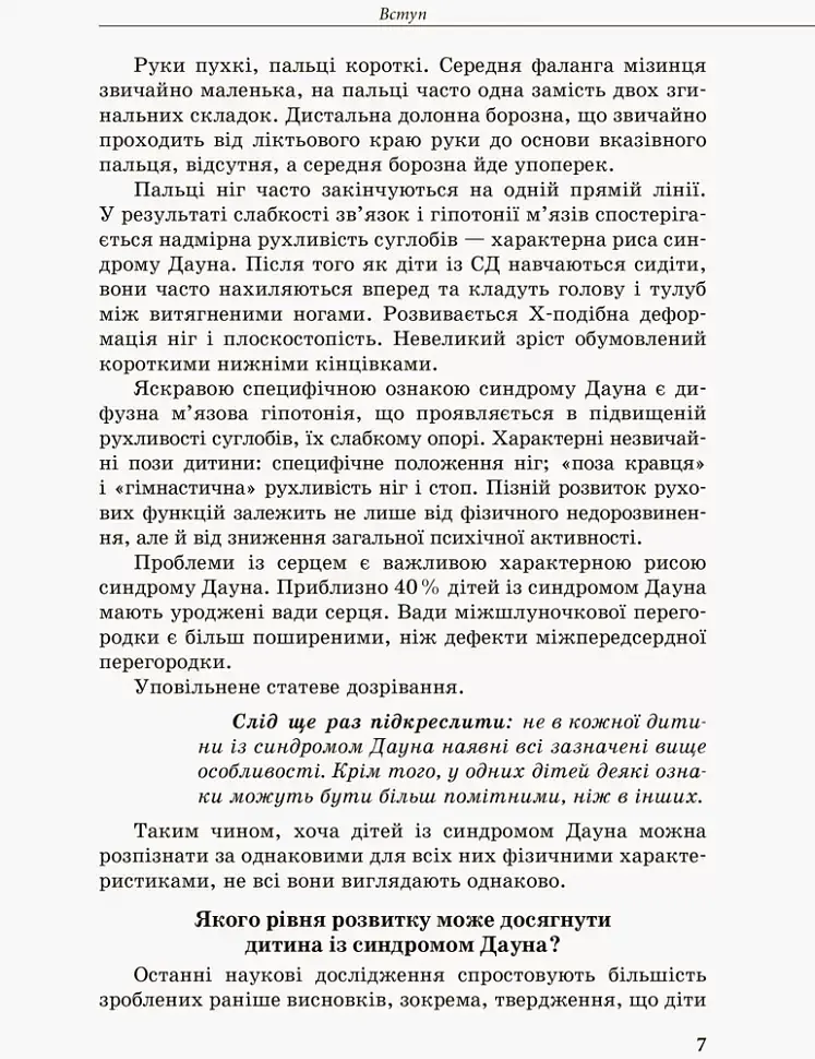 Дитина із синдромом Дауна - фото 3