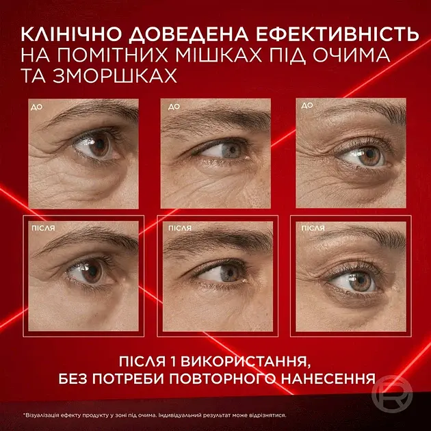 Крем для миттєвого маскування мішків під очима L’Oreal Paris Ревіталіфт Лазер 15 мл - фото 14