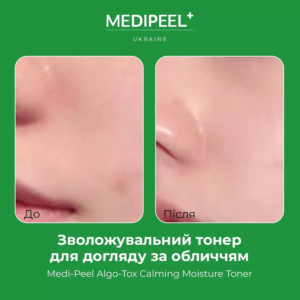 Тонер для обличчя  Medi-Peel Algo-Tox Calming Moisture Toner зволожувальний 250 мл - фото 4