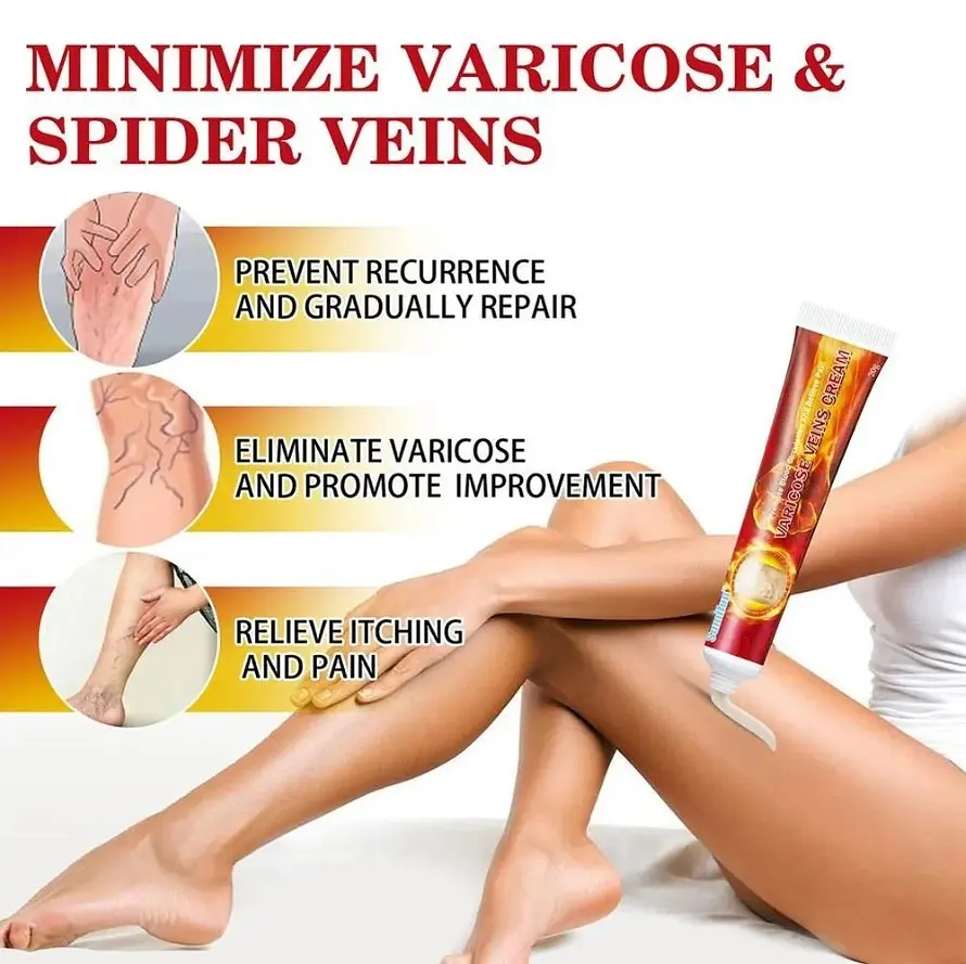 Крем від варикозу Sumifun Varicose Veins Cream 20 г - фото 4