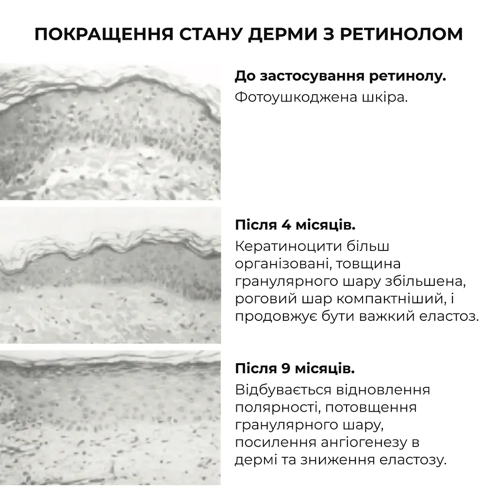 Сироватка для активного відновлення шкіри ReNuAge Retinol Active Renewal Serum Hillary 30 мл - фото 11