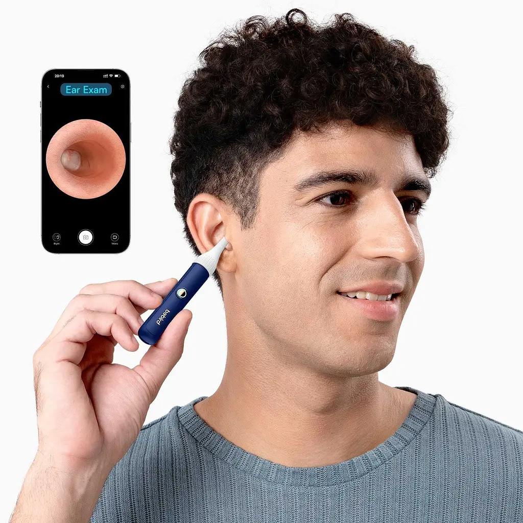 Прилад для видалення вушної сірки (отоскоп) Xiaomi Bebird EarSight Plus (D39R) Blue - фото 8
