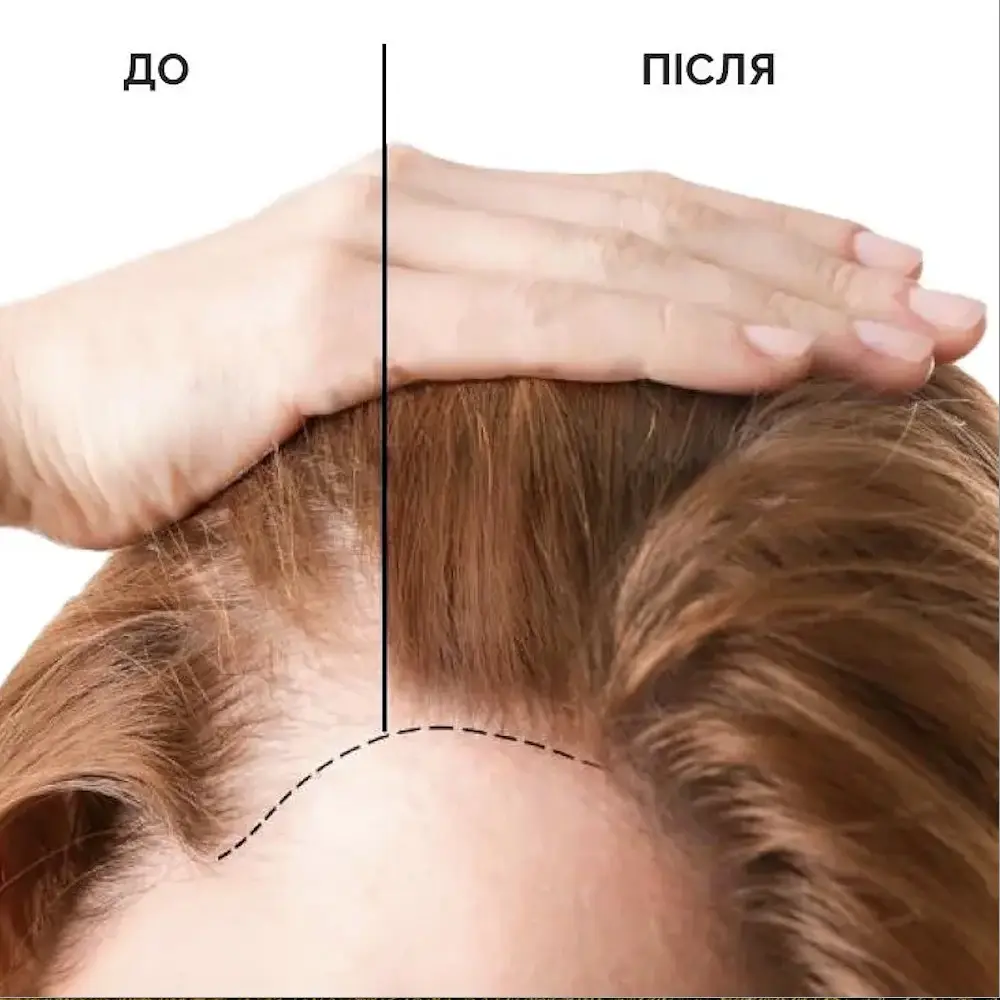 Сыворотка-стимулятор для роста и против выпадения волос Reclaire cosmetics 100 мл - фото 4