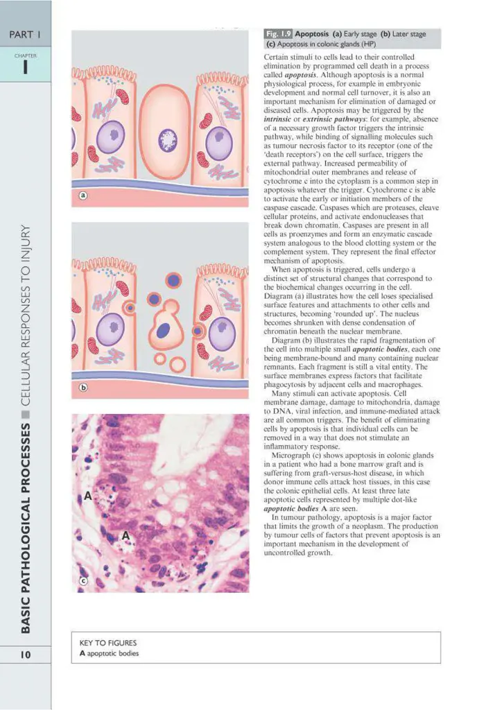 Wheater's Basic Pathology: A Text, Atlas, and Review of Histopathology. International Edition, 5th Edition - Вільям Стюарт - фото 13