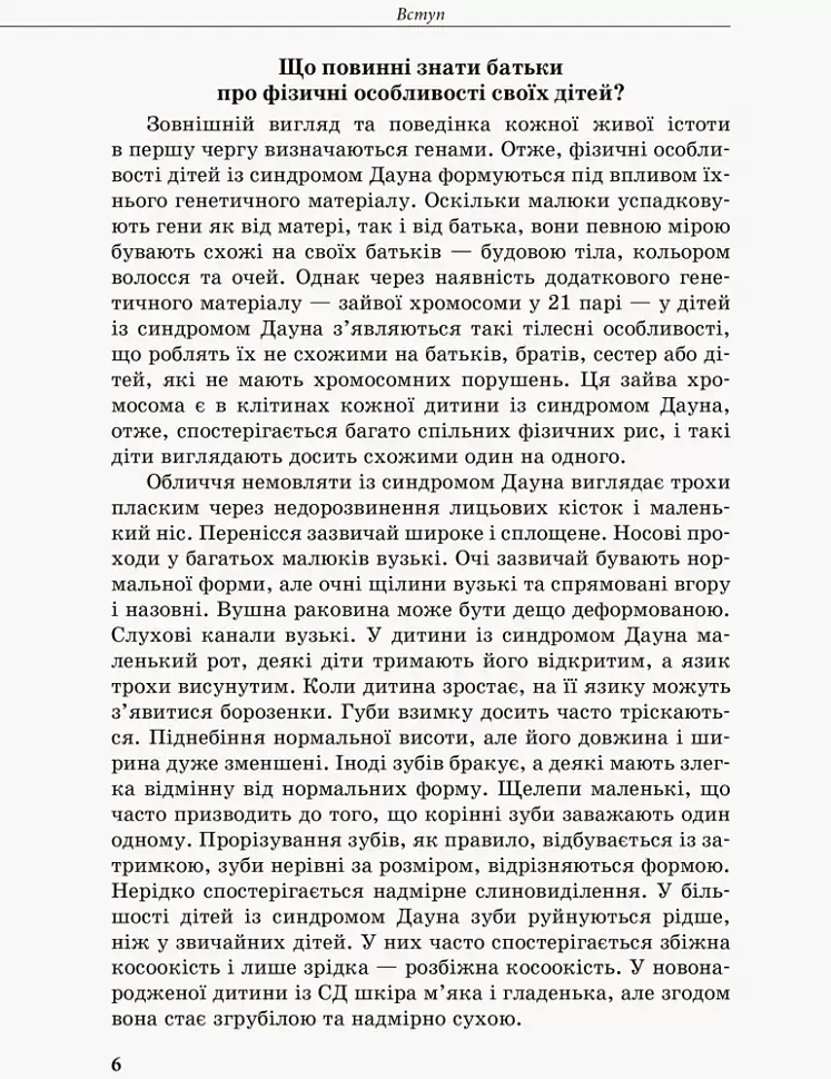 Дитина із синдромом Дауна - фото 2