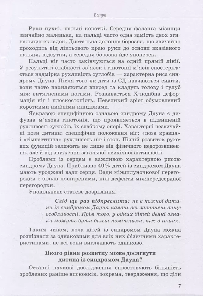 Дитина із синдромом Дауна - фото 6