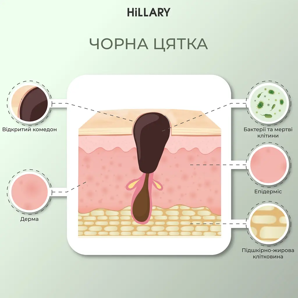 Набір для живлення та зволоження жирної шкіри восени Autumn nutrition and hydration for oil skin Hillary - фото 3