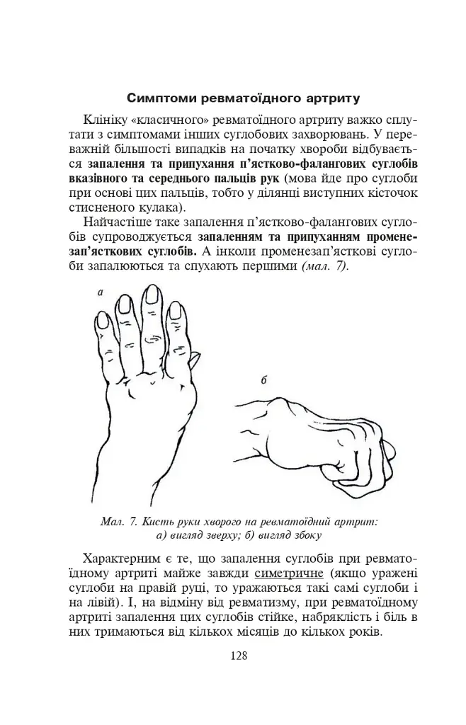 Біль в руках. Отерплість рук. Що потрібно знати про своє захворювання. - фото 4