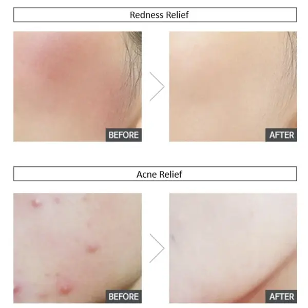 Заспокійливий крем Sur.Medic+ Azulene Soothing Cream 50 мл (SMC004) - фото 5