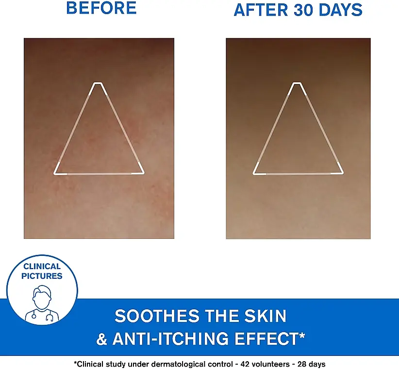 Ліпідовідновлюючий насичений крем Uriage Xemose Cerat проти подразнень 200 мл - фото 6