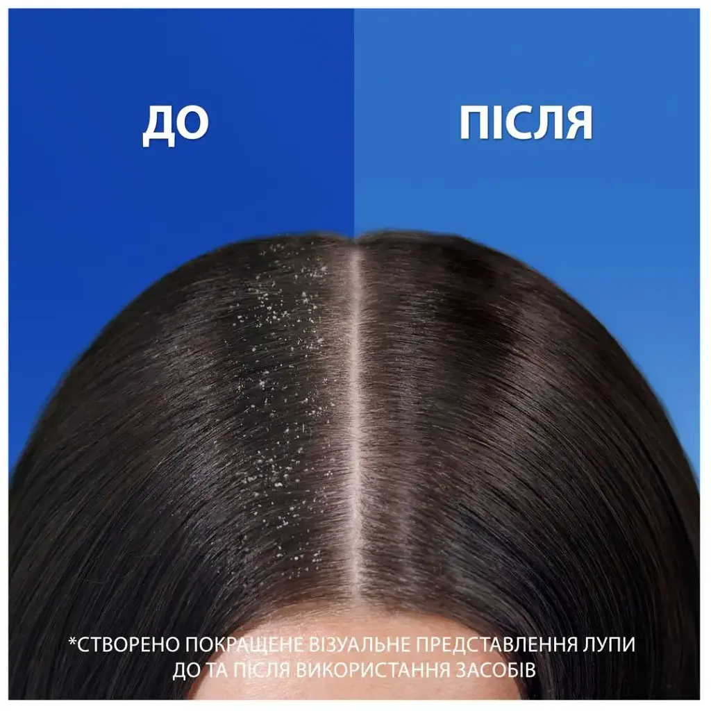 Шампунь проти лупи та бальзам-ополіскувач Head & Shoulders Основний Догляд 2 в 1 360 мл - фото 4