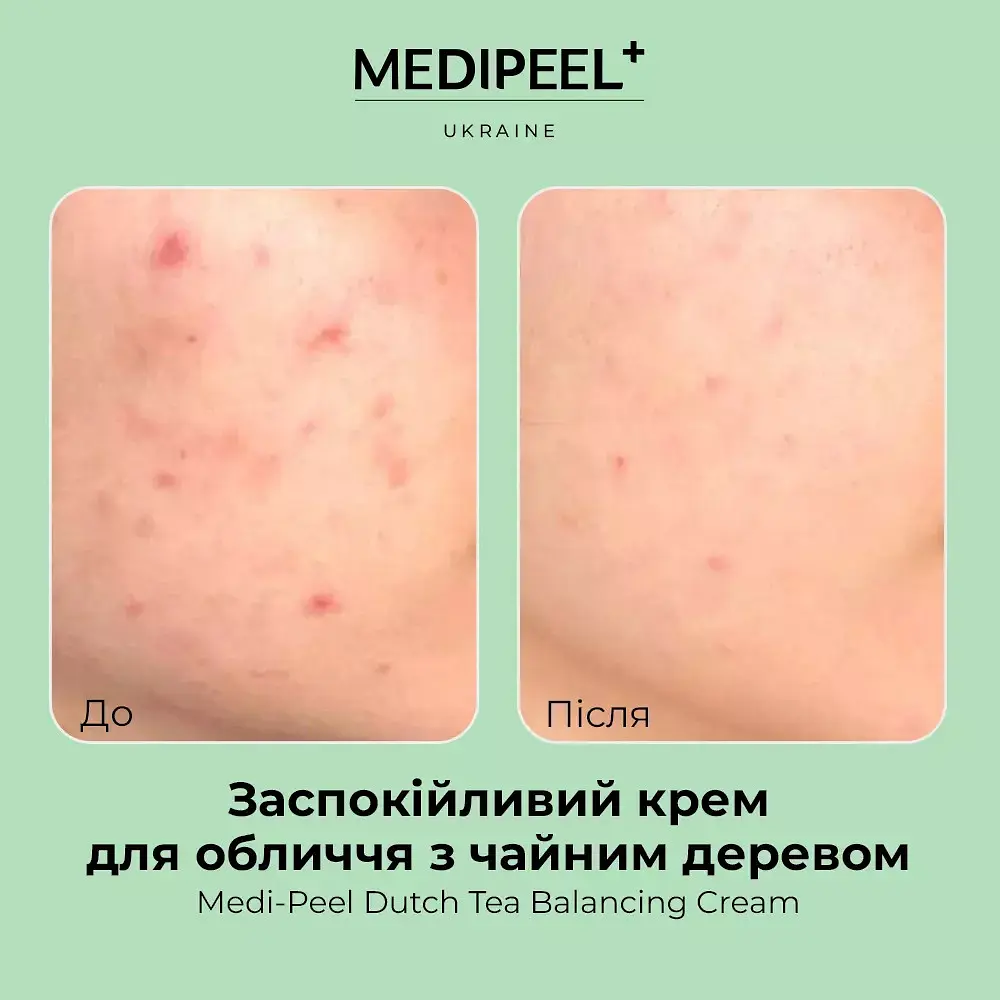 Крем для обличчя Medi-Peel Dutch Tea Balancing Cream заспокійливий з чайним деревом  70 мл - фото 4