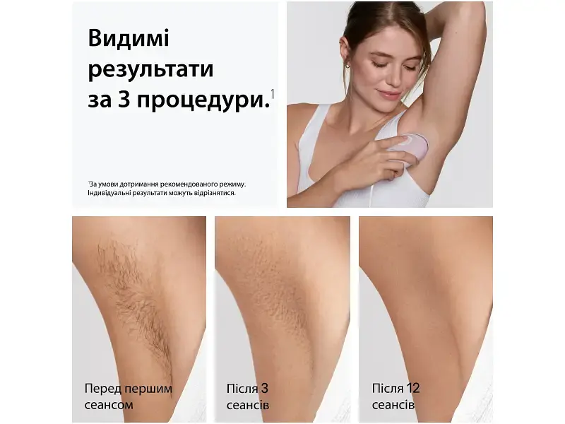 Фотоепілятор Braun Silk-expert Mini PL1111 (8700216937375) - фото 4