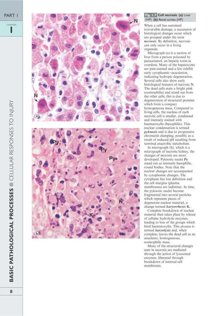 Wheater's Basic Pathology: A Text, Atlas, and Review of Histopathology. International Edition, 5th Edition - фото 11