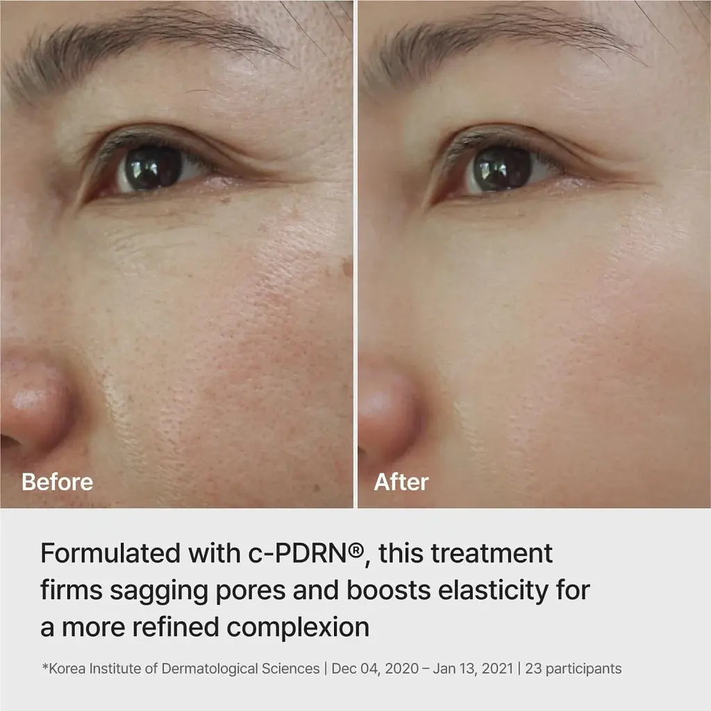Ампульна ліфтинг-маска Rejuran Ampoule Infused Lifting Mask 28 г - фото 2