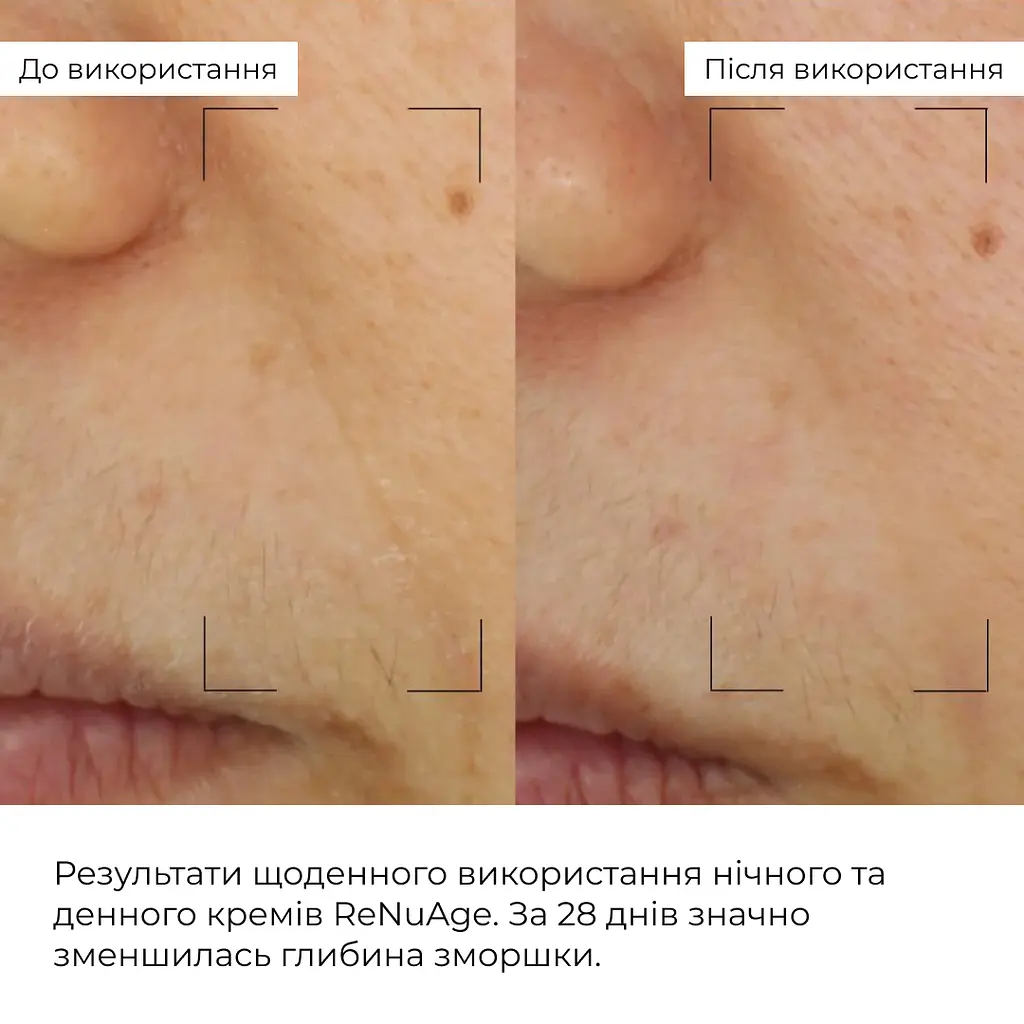 Набор коллагеностимулирующих антивозрастных кремов ReNuAge Collagen-Boosting Anti-Aging Cream Set Hillary - фото 9