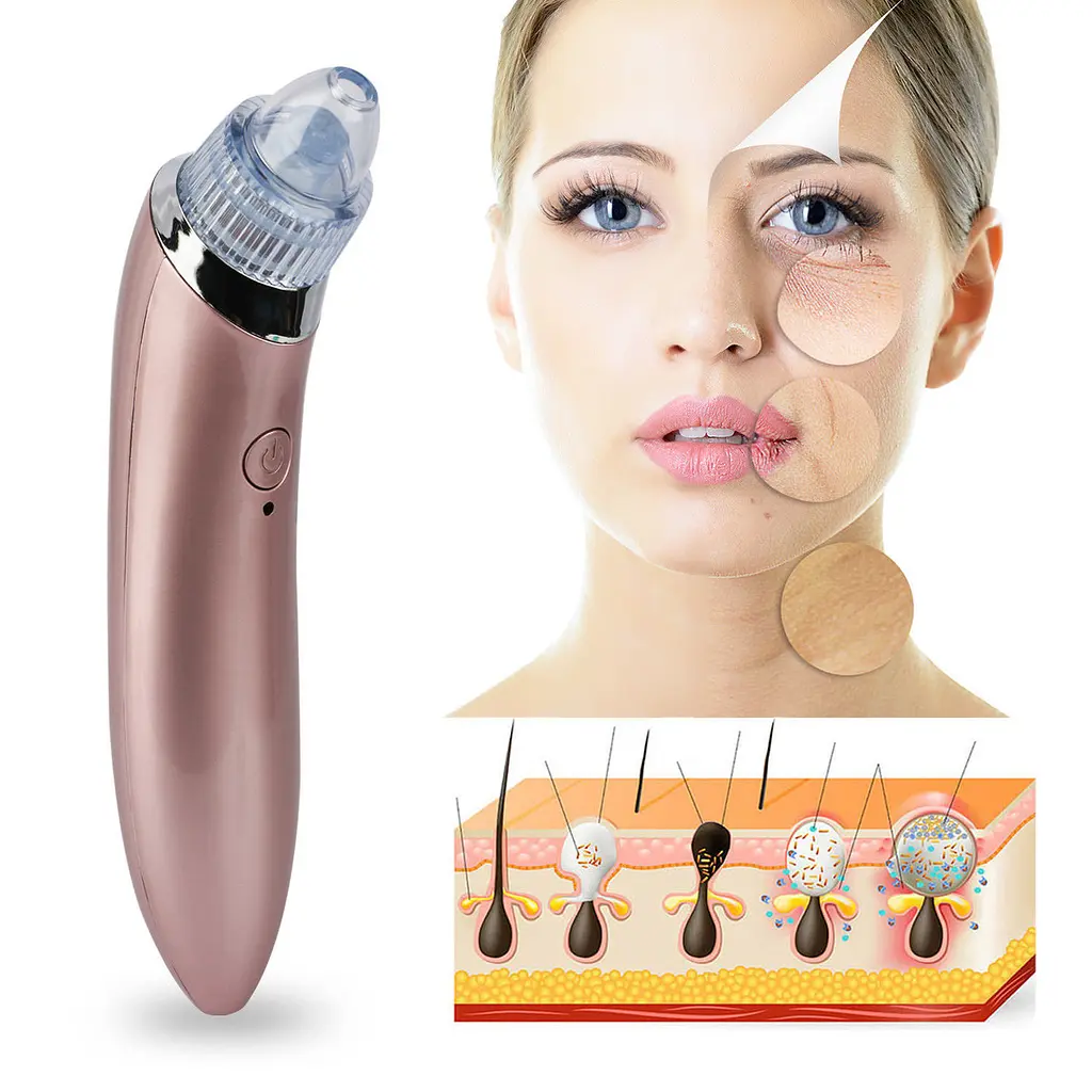 Вакуумний очищувач шкіри Menqahahayd XN-8030 Pink (np2_00120) - фото 7