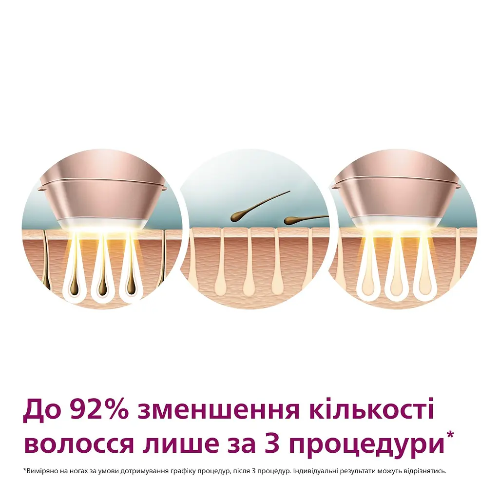 Фотоепілятор Philips Lumea 9900 (BRI973/00) - фото 3