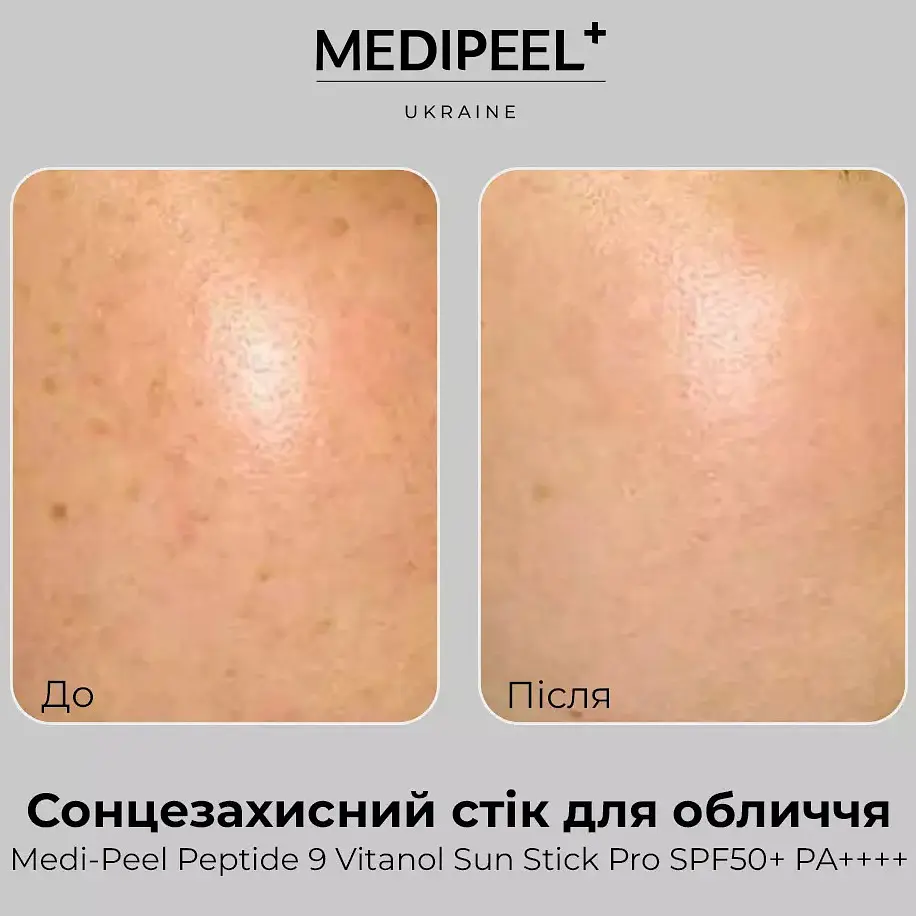 Антивіковий сонцезахисний стік для обличчя Medi Peel Red Peptide 9 Vitanol Sun Stick Pro SPF50+ PA++++ 23 г (MDP190) - фото 6