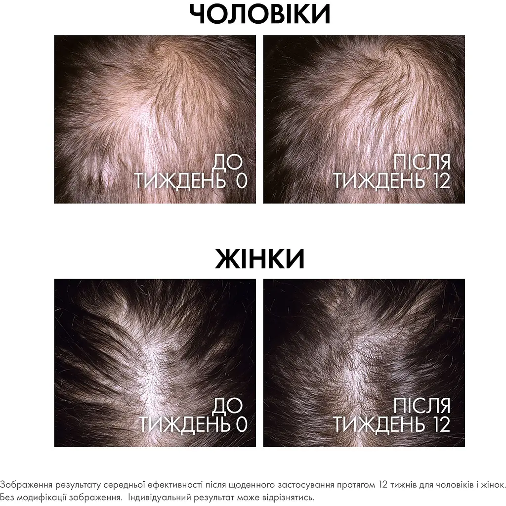 Набір Vichy: Сироватка Dercos Aminexil Clinical Regen Booster для відновлення густоти та боротьби з випадінням волосся 90 мл + шампунь проти випадання волосся Dercos Energy 50 мл + масажний гребінець для миття волосся    - фото 5