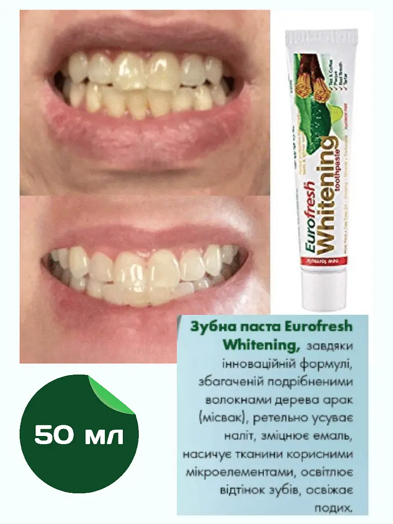 Відбілююча зубна паста Farmasi Eurofresh Whitening 50 г - фото 4