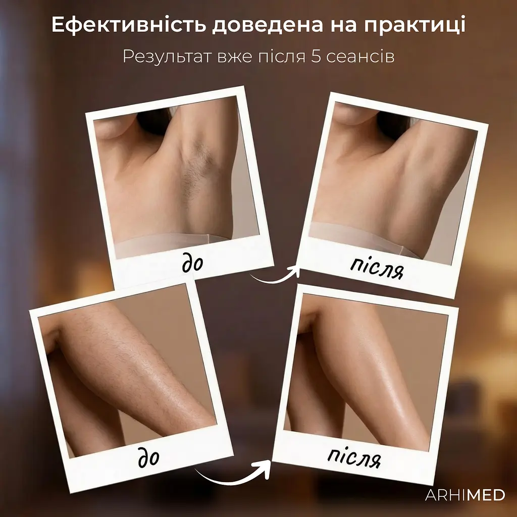 Фотоепілятор ArhiMED IPL Pro  - фото 8