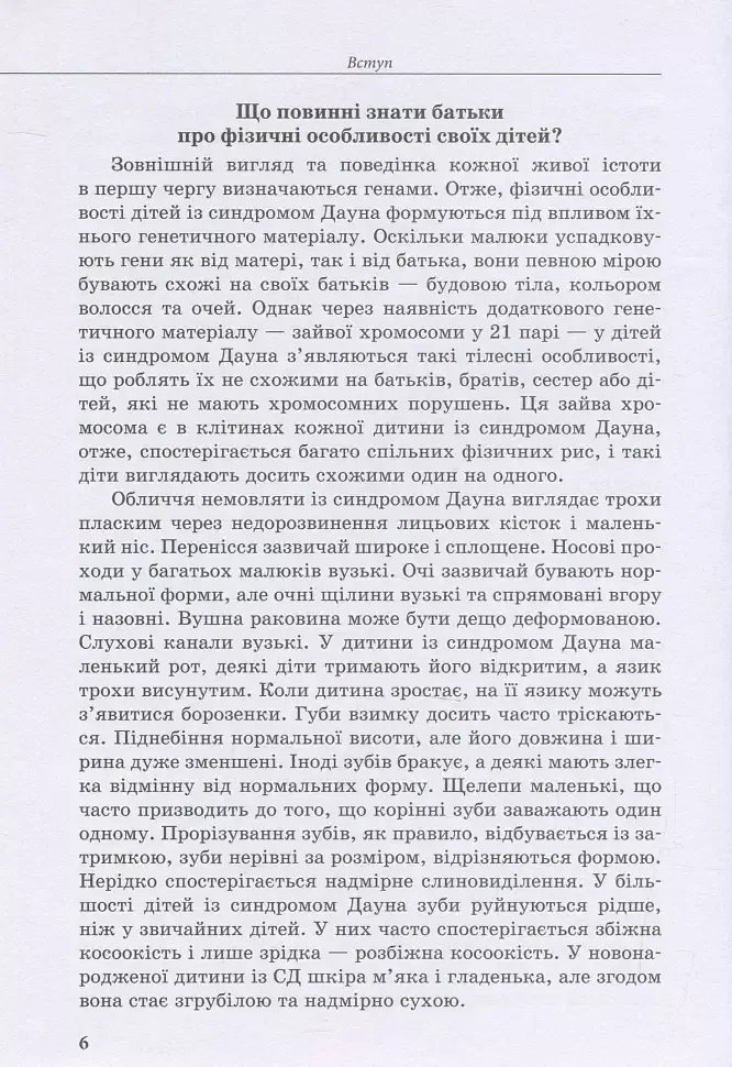Дитина із синдромом Дауна - Ірина Гладченко - фото 5