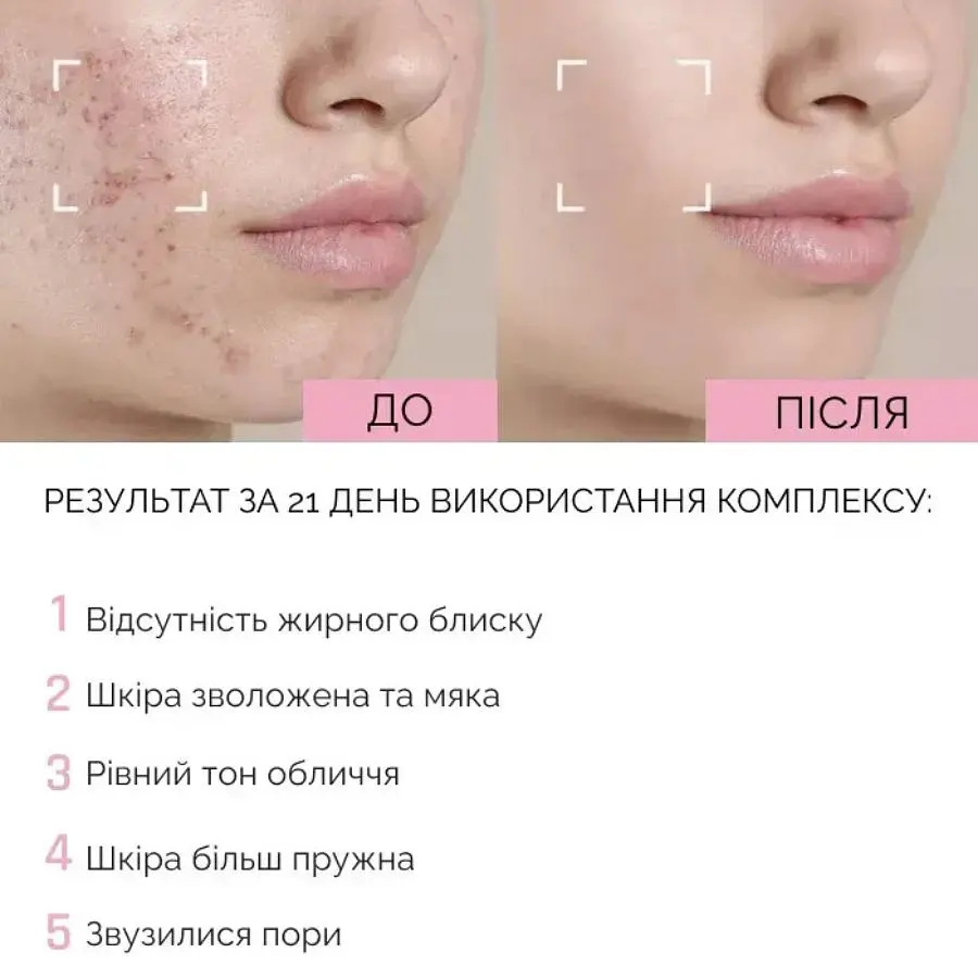 Ніжна пінка для вмивання з ніацинамідом Reclaire cosmetics 150 мл - фото 4