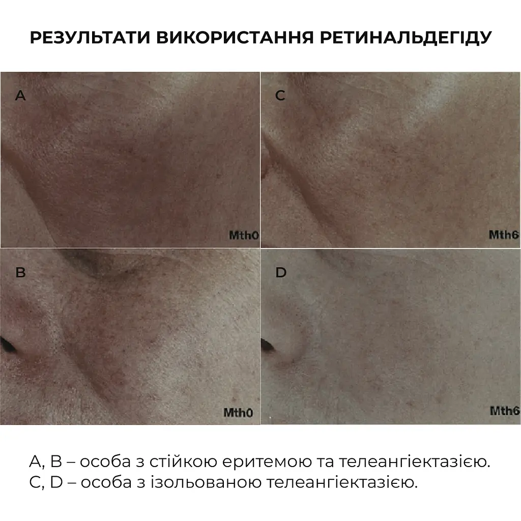 Нічна інтенсивна сироватка з ретиналем Night Intense Retinal Serum Hillary 30 мл - фото 5