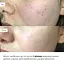 Глиняная детокс-маска для проблемной кожи лица Anti-Acne & Detox Clay Mask Hillary 90 мл - миниатюра 4
